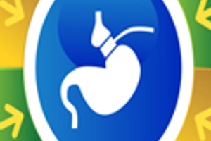 Anneau Gastrique Hypnotique